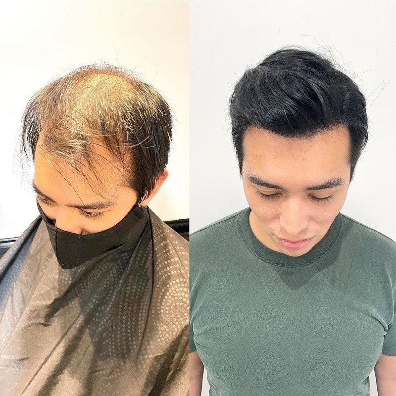 LaVivid Mirage Toupet | Superdünne Folie | LaVividHair