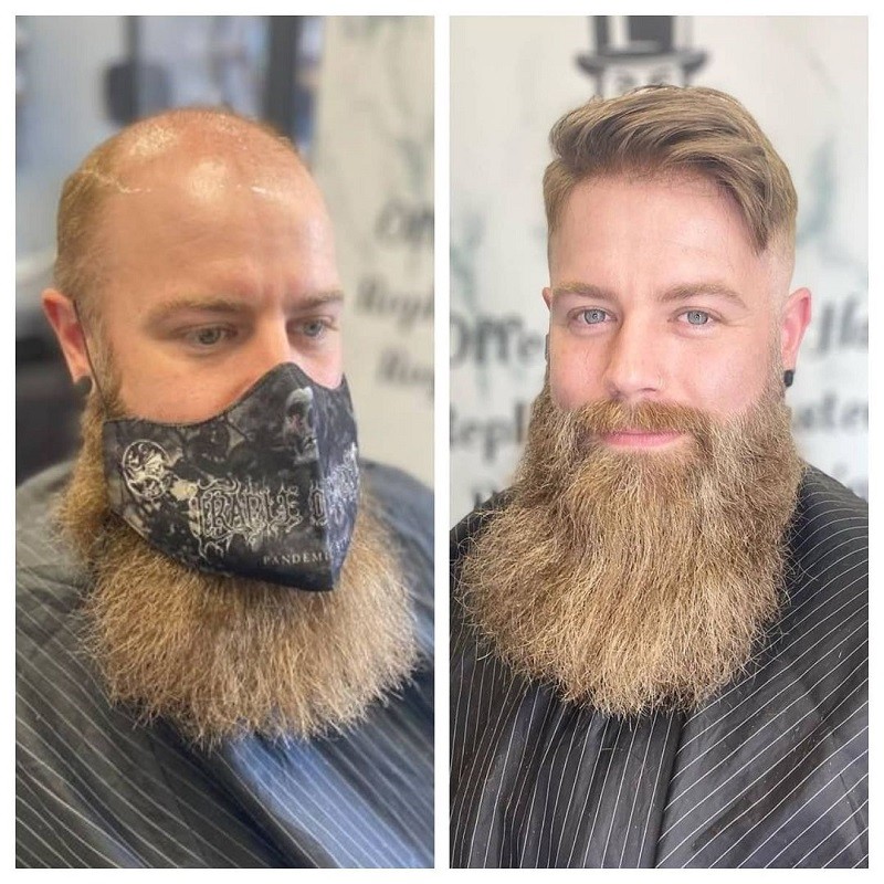 Ares nicht-chirurgischer Haarersatz | Täglicher Gebrauch | LaVividHair