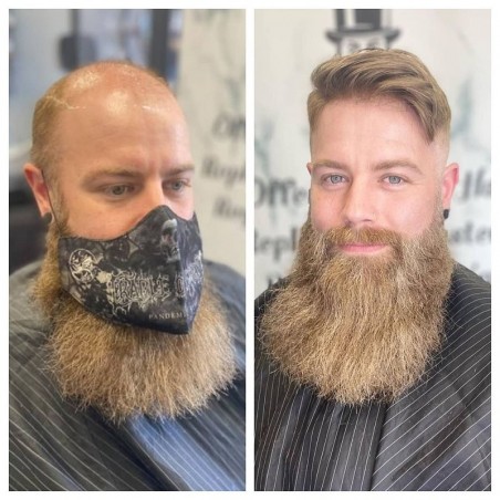 Ares nicht-chirurgischer Haarersatz | Täglicher Gebrauch | LaVividHair Ares nicht-chirurgischer Haarersatz | Täglicher Gebrauch | LaVividHair