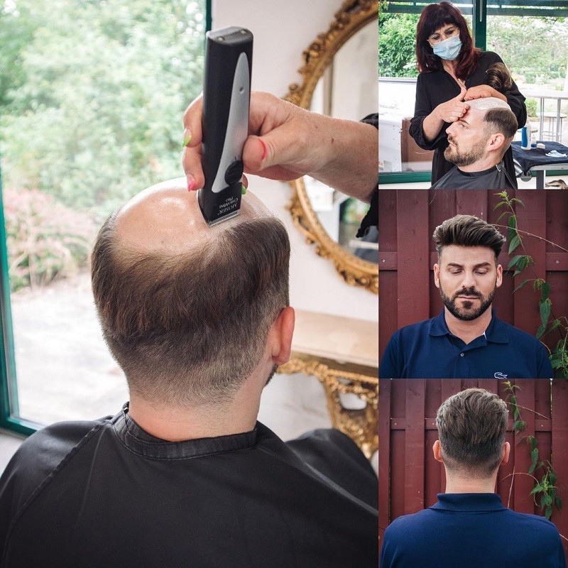 Coeus Herren-Haarersatz | Dünne Hautbasis | LaVividHair