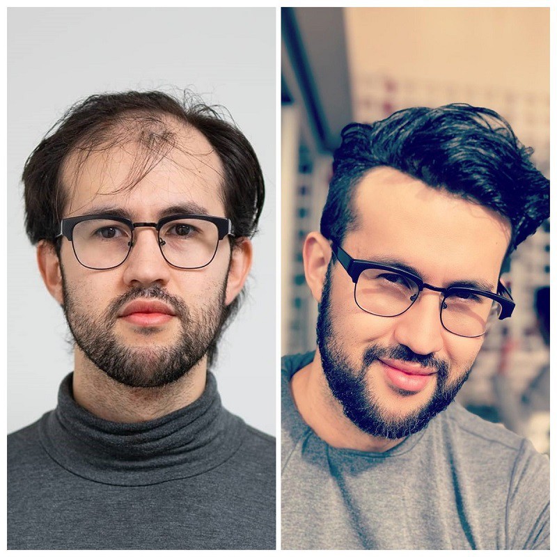 Sanders 80% Leichte Dichte Vollspitzen Haarsystem | LaVividHair