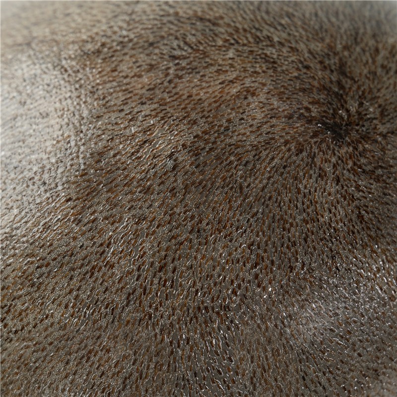 Taylor Damen Haa|Nicht-chirurgische Lösung für dünner werdendes Haar