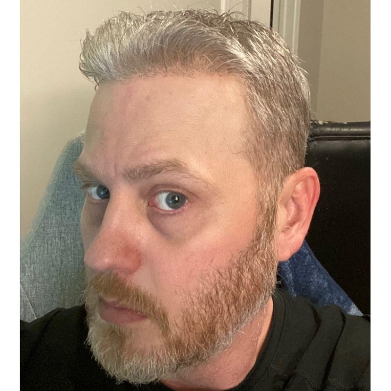 LaVivid Helios Haarsystem | Swiss Lace | LaVividHair