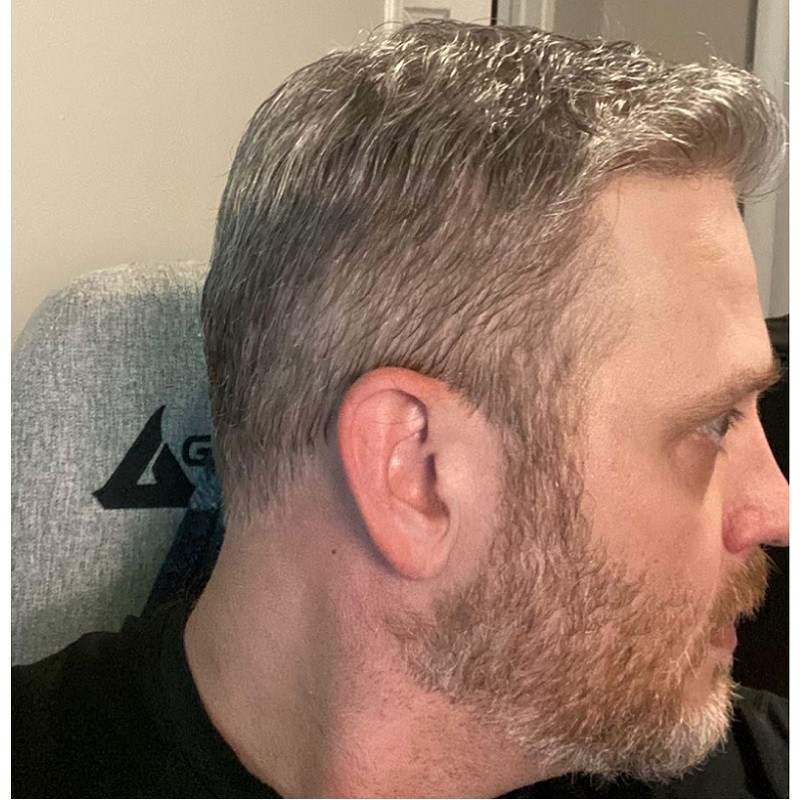 LaVivid Helios Haarsystem | Swiss Lace | LaVividHair