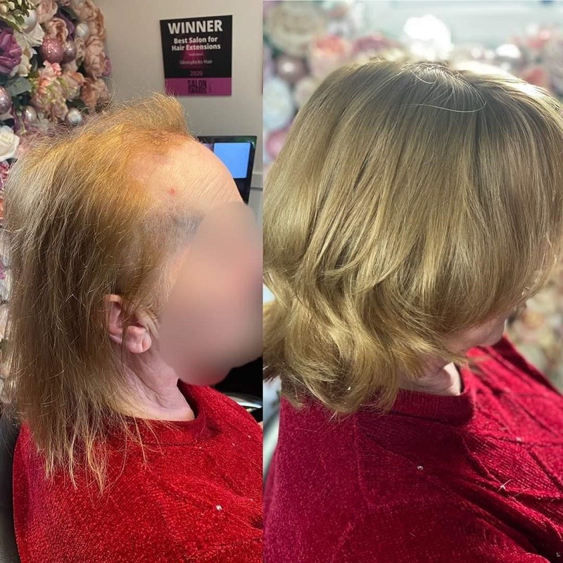 Cronus Haarausfallbehandlung|Volle Polyskin Basis|Europäisches Haar