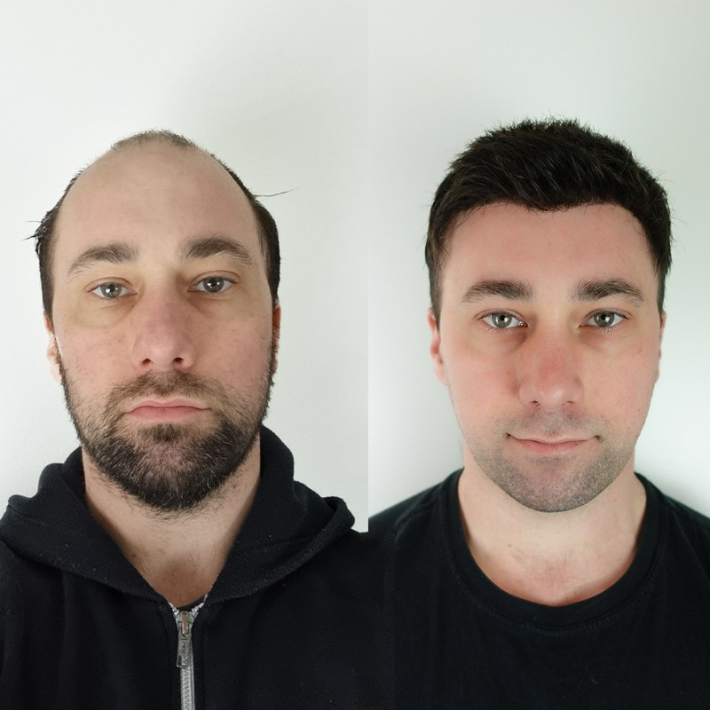 LaVivid Mirage Toupet | Superdünne Folie | LaVividHair