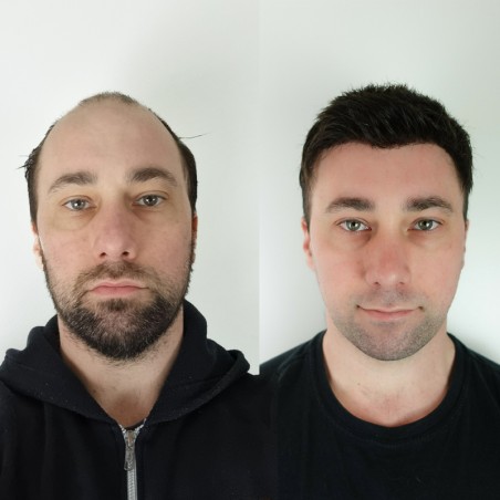 LaVivid Mirage Toupet | Superdünne Folie | LaVividHair LaVivid Mirage Toupet | Superdünne Folie | LaVividHair