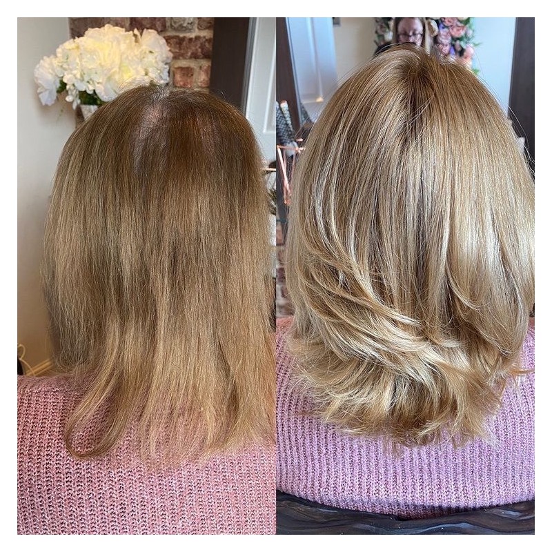 Taylor Damen Haa|Nicht-chirurgische Lösung für dünner werdendes Haar