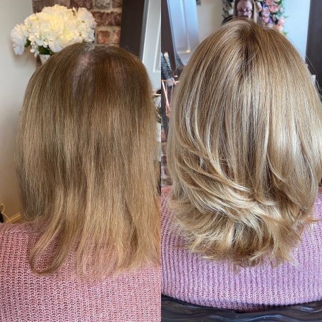 Taylor Damen Haa|Nicht-chirurgische Lösung für dünner werdendes Haar