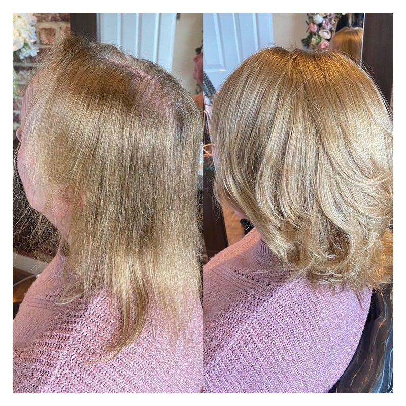 Taylor Damen Haa|Nicht-chirurgische Lösung für dünner werdendes Haar