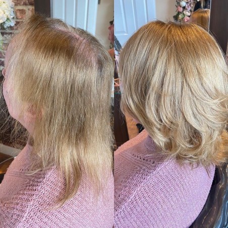 Taylor Damen Haa|Nicht-chirurgische Lösung für dünner werdendes Haar