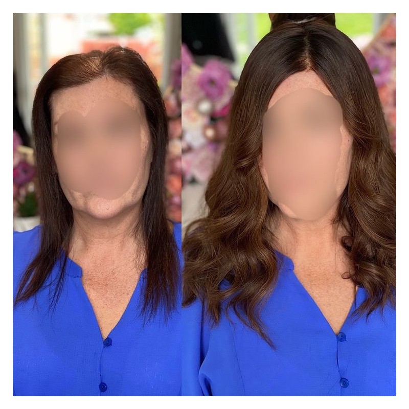 Taylor Damen Haa|Nicht-chirurgische Lösung für dünner werdendes Haar