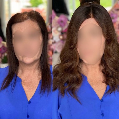 Taylor Damen Haa|Nicht-chirurgische Lösung für dünner werdendes Haar