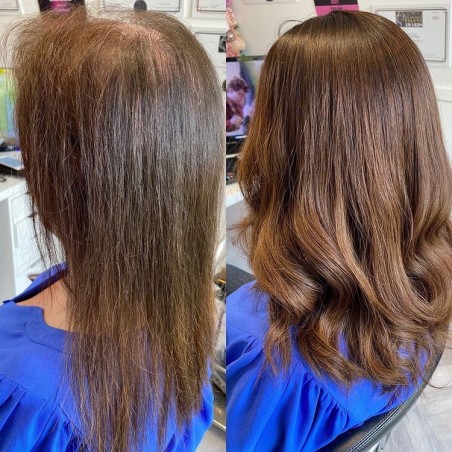 Taylor Damen Haa|Nicht-chirurgische Lösung für dünner werdendes Haar