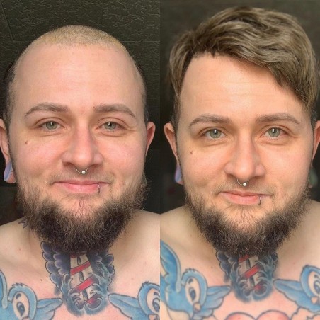 Ares nicht-chirurgischer Haarersatz | Täglicher Gebrauch | LaVividHair Ares nicht-chirurgischer Haarersatz | Täglicher Gebrauch | LaVividHair