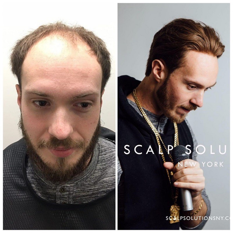 Thor Herren-Spitzentoupee | Französische Spitze | LaVividHair