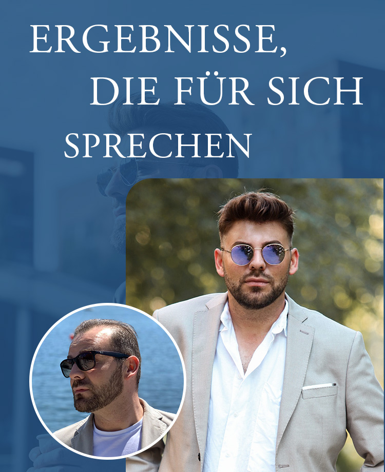 Perücken für Männer